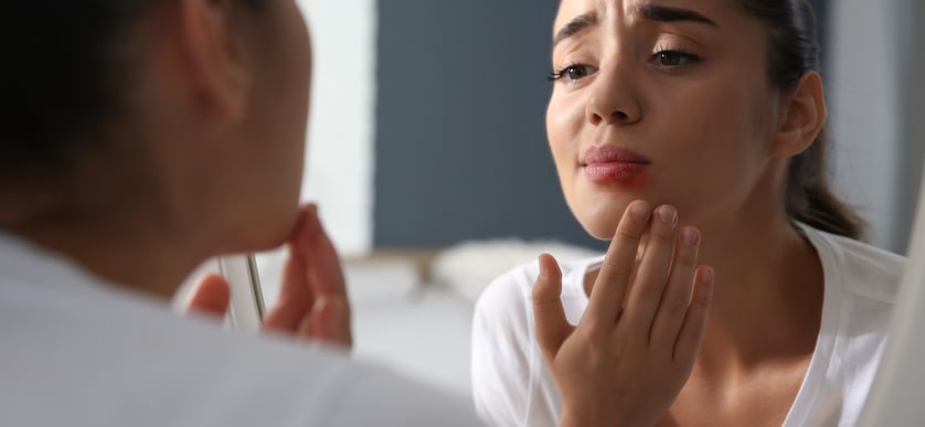 Perioral dermatit – tips och behandling