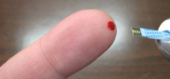 Barndiabetes – vad behöver jag som förälder tänka på? 