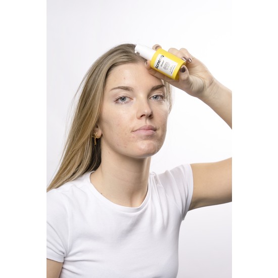Niche Beauty Lab Zitcalm Serum 30 ml