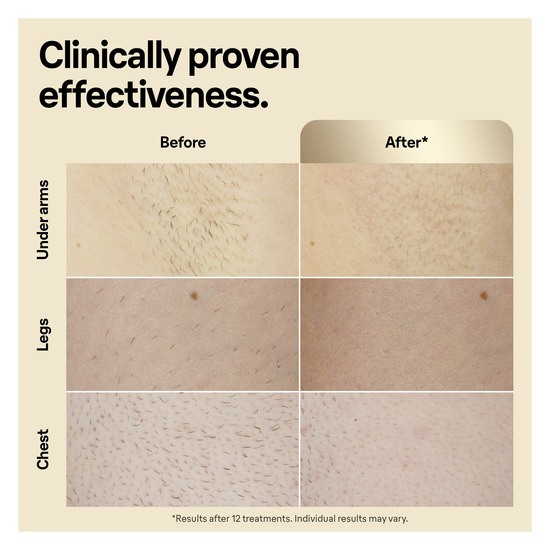 Braun IPL Silk·expert Pro 5 PL5052