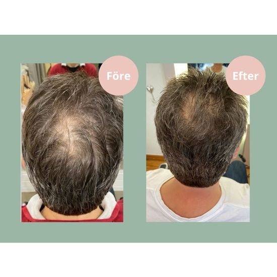 Hjärtligt Hair Growth Balsam 250 ml