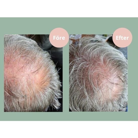 Hjärtligt Hair Growth Balsam 250 ml