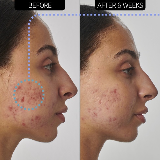 The INKEY List Retinol 1% Serum 30 ml 