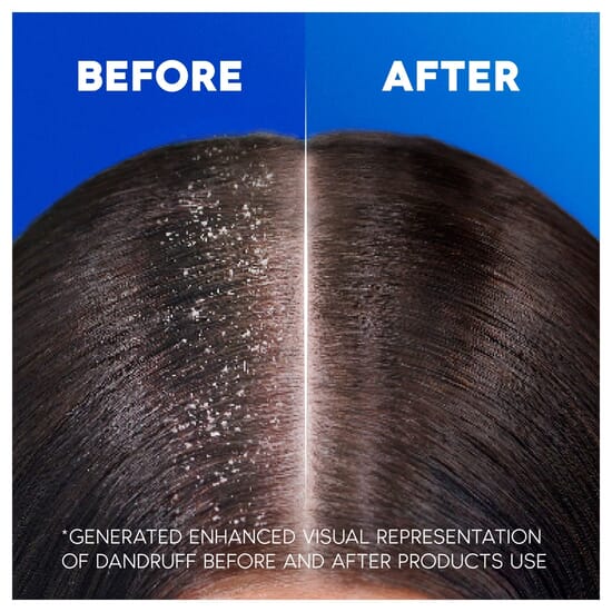 Head & Shoulders Deep Hydration Shampoo mot mjäll med kokosolja 250 ml