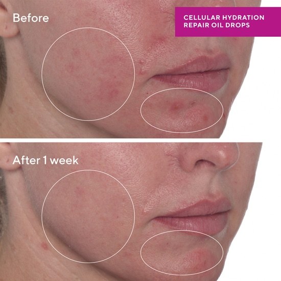 Murad Cellular Hydration Repair Oil Drops 30 ml