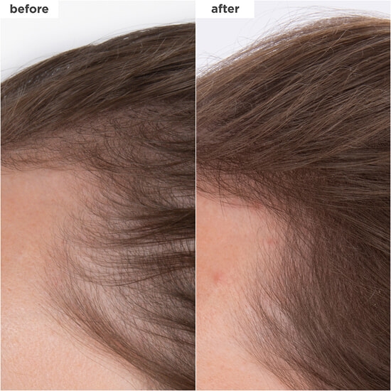 Briogeo Destined for Density MegaStrength+ Caffeine + Biotin Peptide Density Serum 45 ml