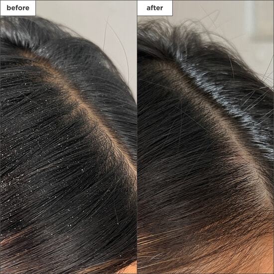 Briogeo Scalp Revival Charcoal + Tea Tree Buildup Detox Spray 120 ml