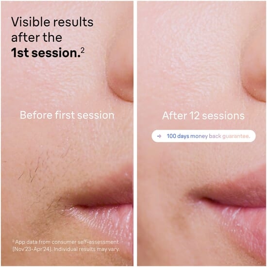 Braun Smart IPL Skin i·Expert PL7147