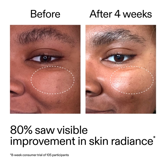 The INKEY List Advanced Retinal Serum 15 ml