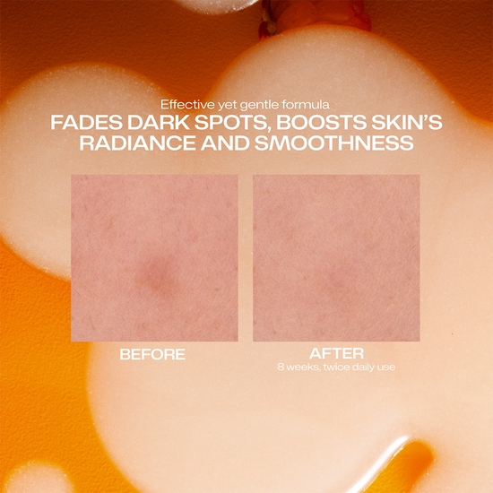 Lumene Dark Spot Serum 30 ml