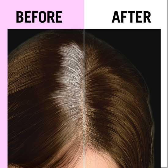 Schwarzkopf Root Retoucher Brown 120 ml