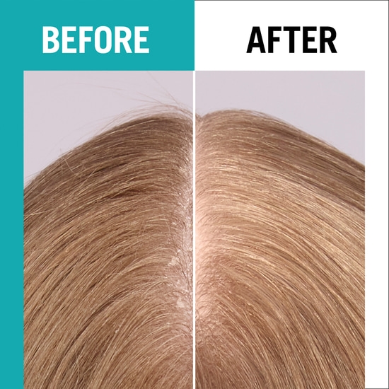 Schwarzkopf Gliss Scalp Balance Scalp Spray 100 ml