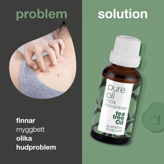 Australian Bodycare Pure Oil 30 ml