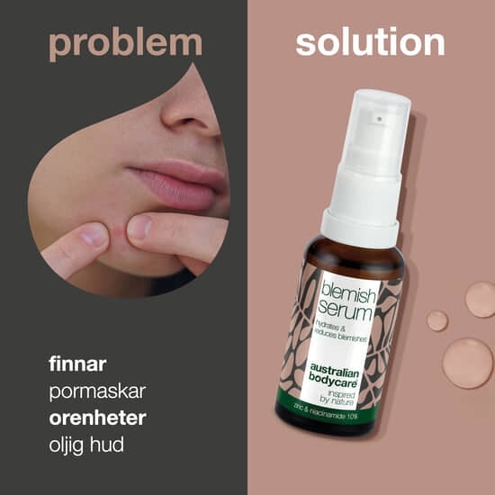 Australian Bodycare Blemish Serum 30 ml