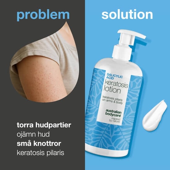 Australian Bodycare Salicylic Acid Keratosis Lotion 500 ml