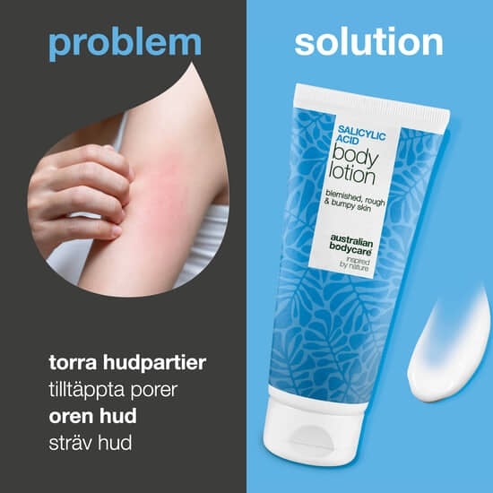 Australian Bodycare Salicylic Body Lotion 200 ml