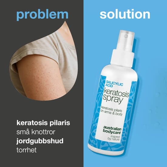 Australian Bodycare Salicylic Acid Keratosis Spray 100 ml
