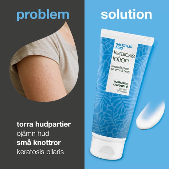 Australian Bodycare Salicylic Acid Keratosis Lotion 200 ml
