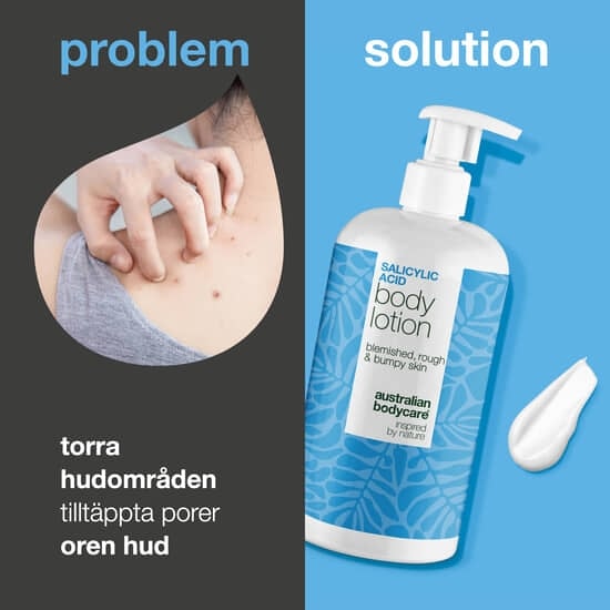 Australian Bodycare Salicylic Acid Body Lotion 500 ml