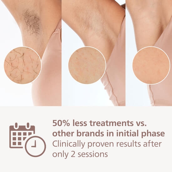 Philips Lumea IPL 8000 Series BRI946/00
