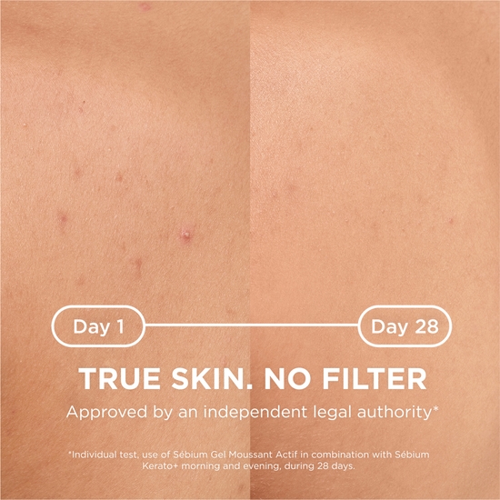 Bioderma Sébium Kerato+ Anti Blemish Body Spray 150 ml