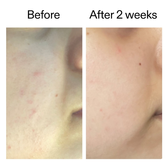 The INKEY List 360 Skin Clearing Serum 30 ml