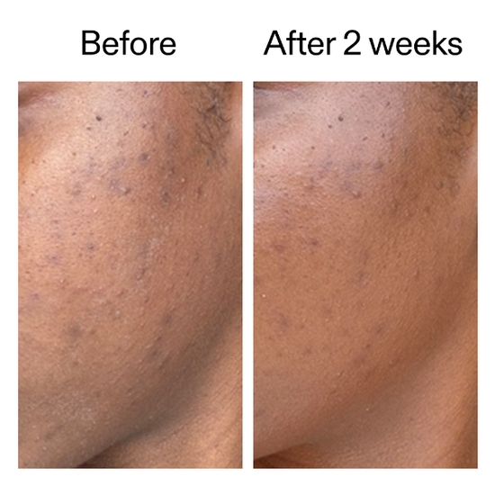 The INKEY List 360 Skin Clearing Serum 30 ml