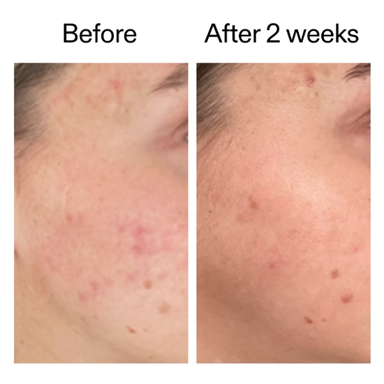 The INKEY List 360 Skin Clearing Serum 30 ml