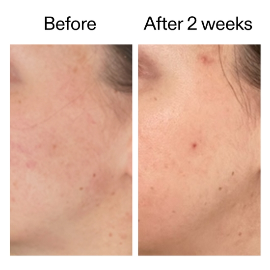 The INKEY List 360 Skin Clearing Serum 30 ml