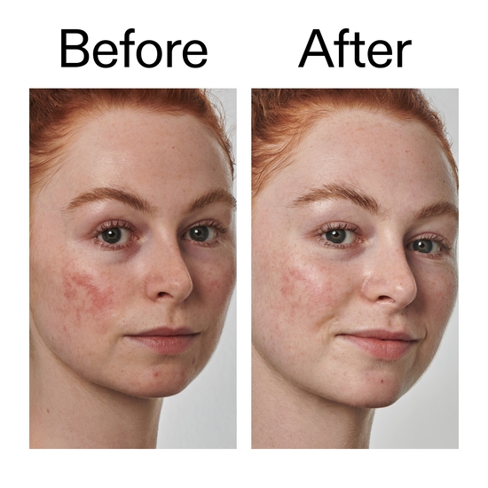 The INKEY List Azelaic Acid 10% Serum 30 ml 