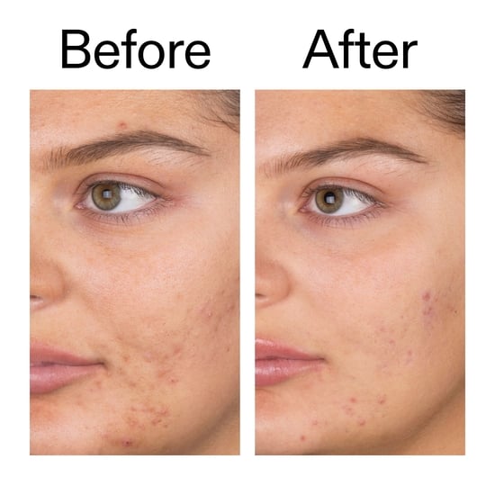 The INKEY List Salicylic Acid Cleanser 150 ml 
