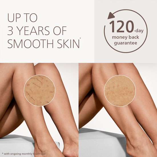 Philips Lumea IPL 7000 Series BRI930/00