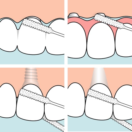 TePe Bridge & Implant Floss 30 st
