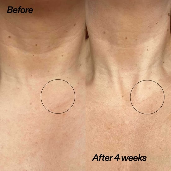 The INKEY List Bio-Active Ceramide Neck Lift Stick 20 g