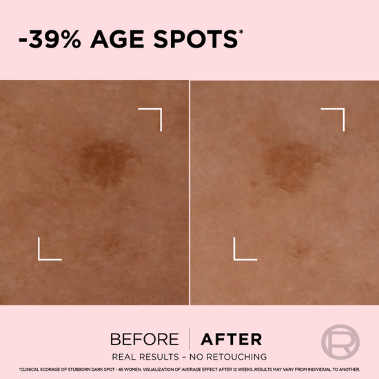 L'Oréal Paris Age Perfect Age Spot Rapid Corrector Serum 30 ml