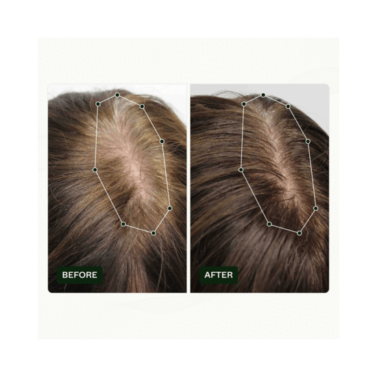 Scandinavian Biolabs Hair Routine Kit Women