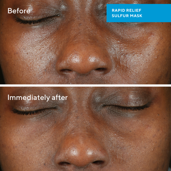 Murad Rapid Relief Sulfur Mask 75 ml