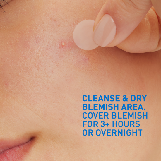 CeraVe Blemish Barrier Patches 22 st