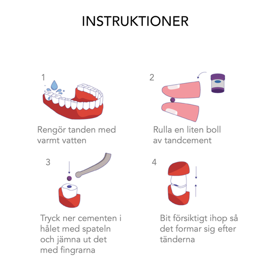 Ekulf Tooth Repair Kit