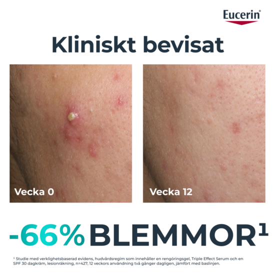 Eucerin DermoPure Triple Action Serum 40 ml