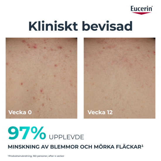 Eucerin Dermopure Correcting Body Care 200 ml
