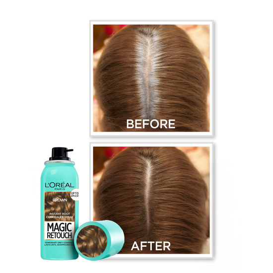 L'Oréal Paris Magic Retouch Direktverkande Hårfärg 2 Dark Brown 75 ml