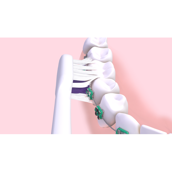 GUM Sonic Ortho Tandborste Mjuk 1 st
