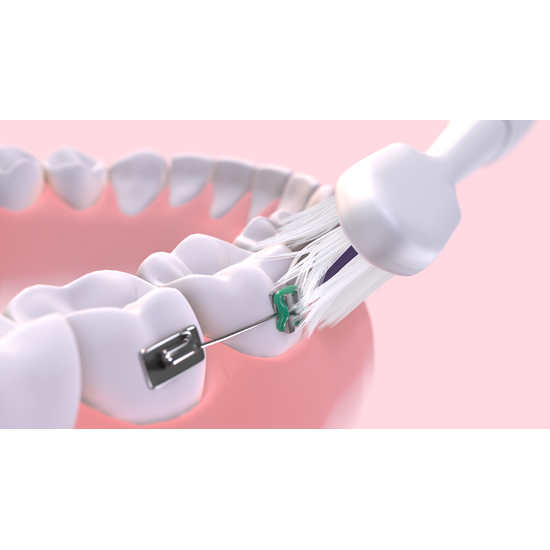 GUM Sonic Ortho Tandborste Mjuk 1 st