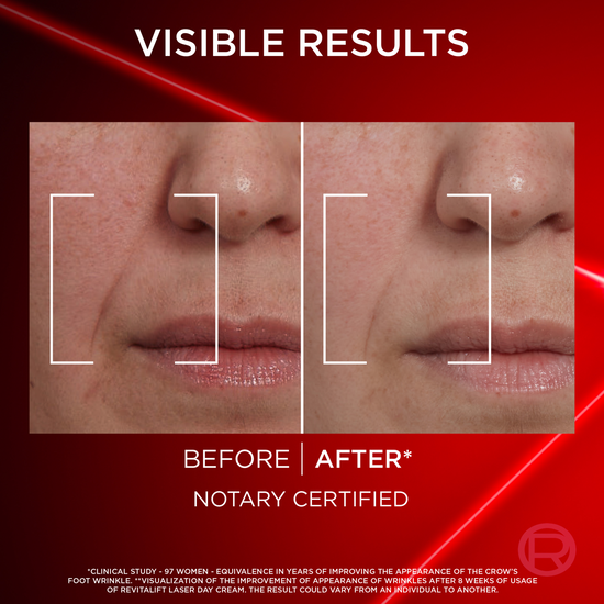 L'Oréal Paris Revitalift Laser Dagkräm 50 ml