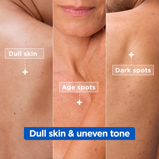 Mixa Niacinamide Bright Moisturizing Anti-Dark Spot Cream för mycket torr & matt hud 400 ml
