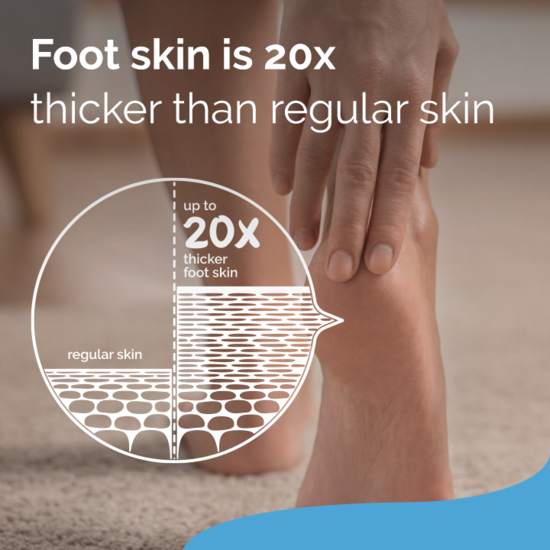 Scholl Intense Nourishing Foot Cream 150 ml