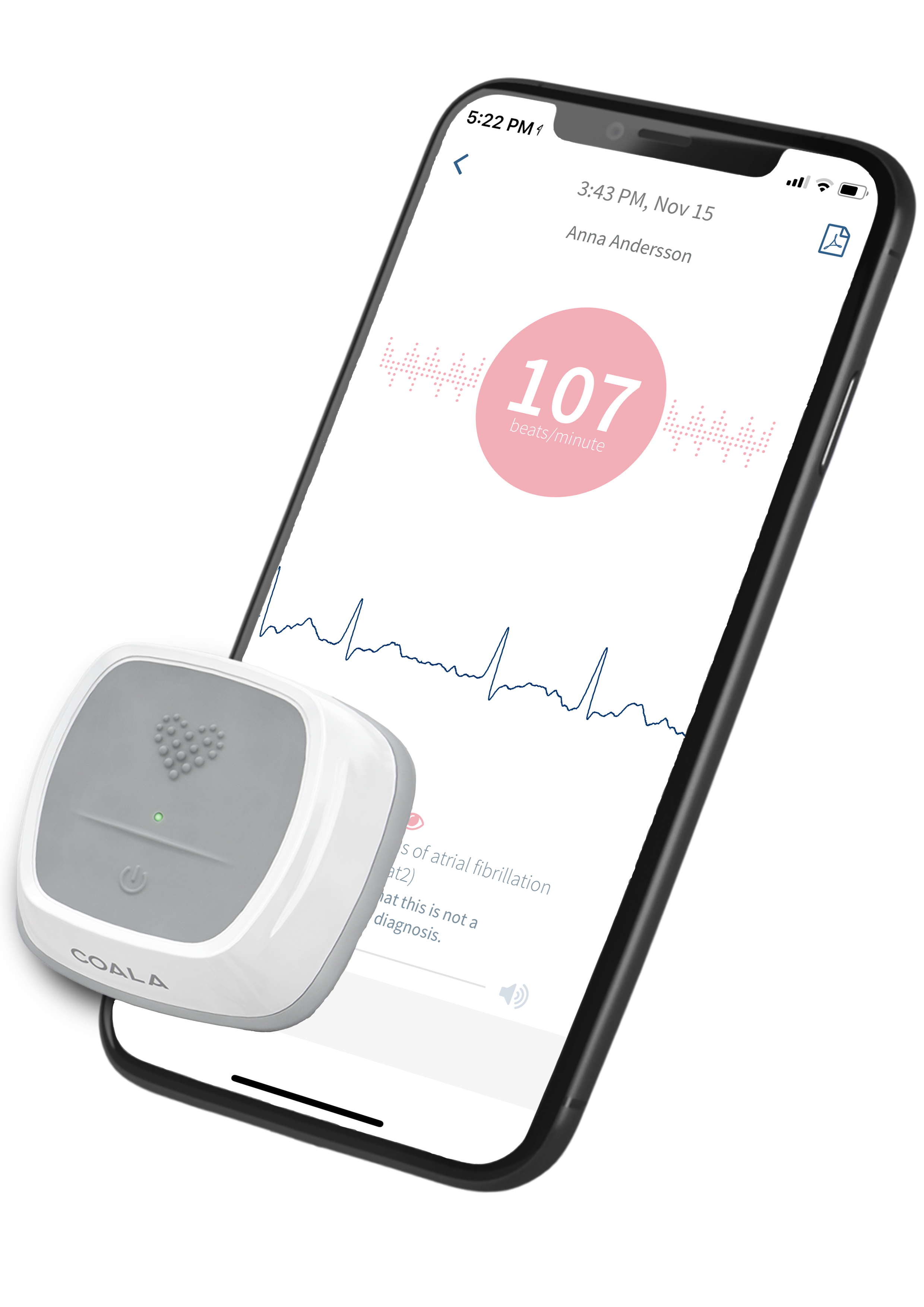 Coala Heart Monitor inkl 12 månaders abonnemang